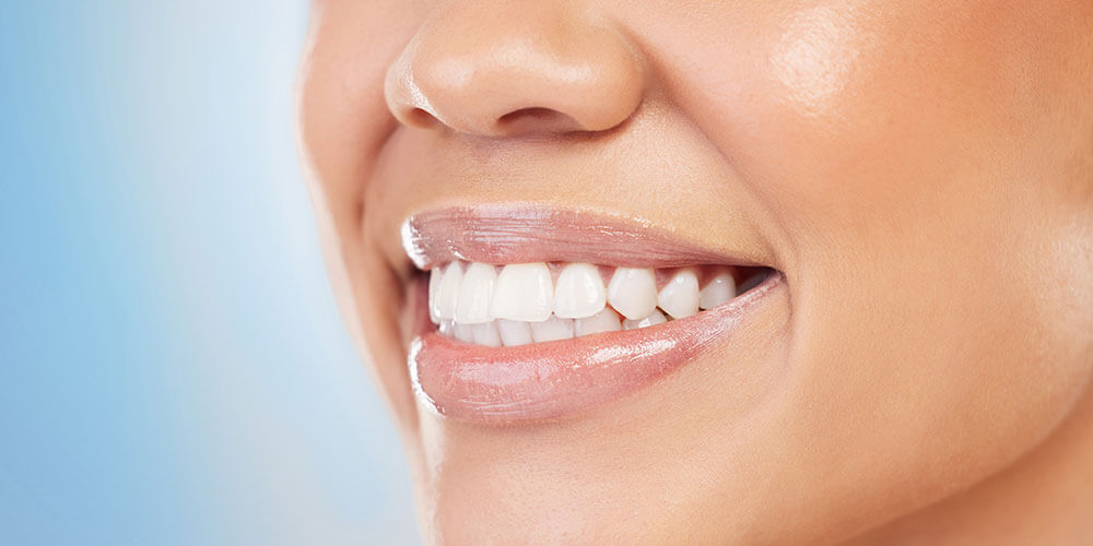 Fluoride Treatment